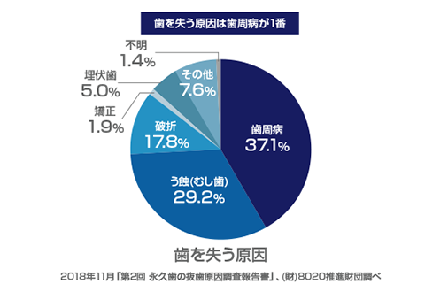 永久歯を失う原因の第1位は歯周病