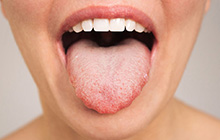 舌や粘膜の変色が気になる