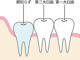 正常なタイプ