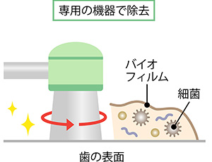 プロフェッショナルなクリーニング